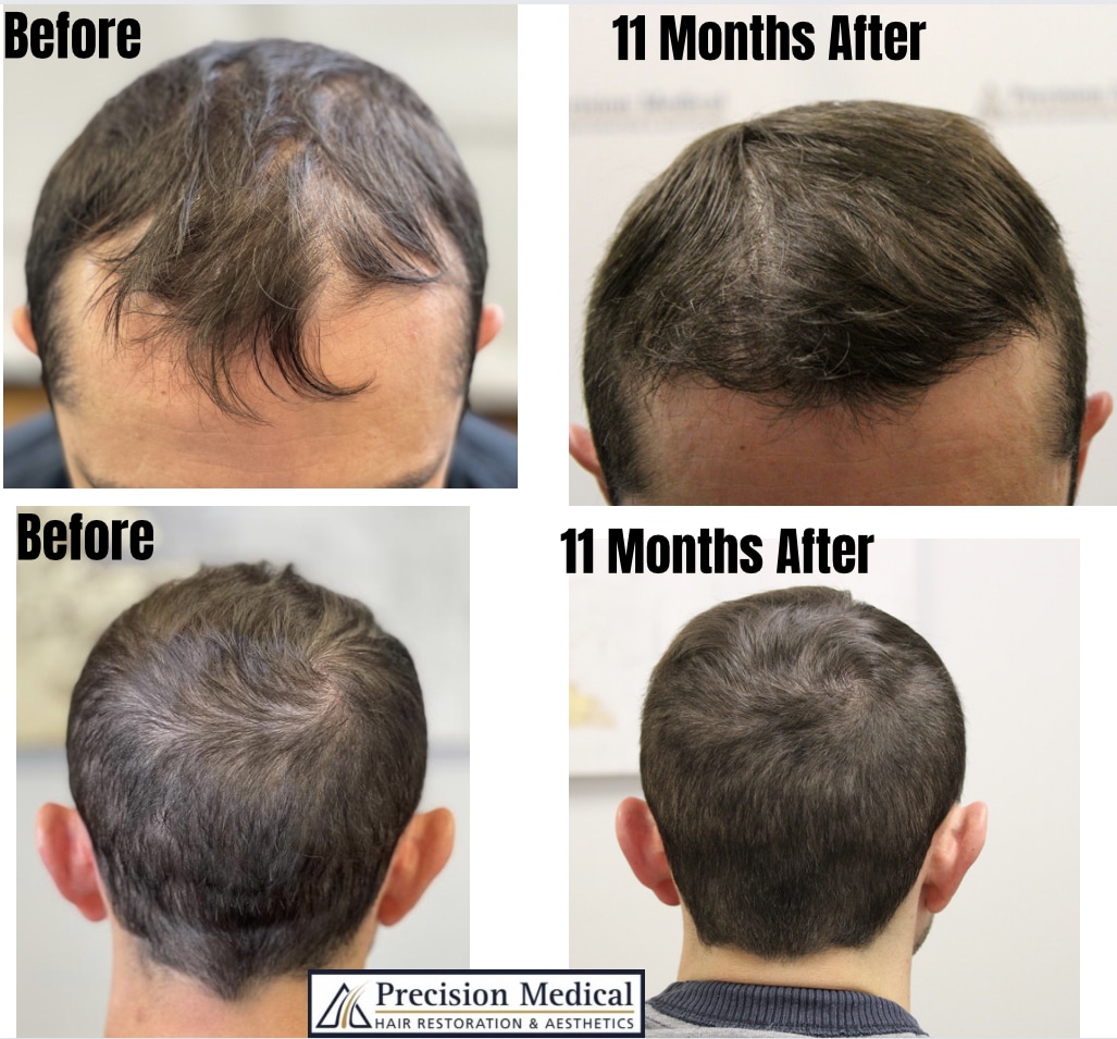Patient examples